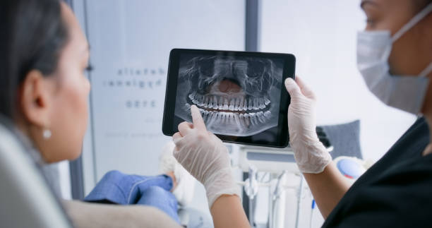 Licensed Wisdom Tooth Removal service in Novato, CA - Smile Center Dentistry